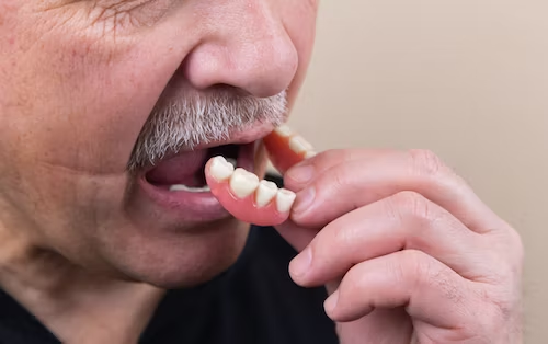 The Effects of Mouth Larvae on Humans: An Uncommon yet Upsetting Experience 5 The Effects of Mouth Larvae on Humans: An Uncommon yet Upsetting Experience 4
