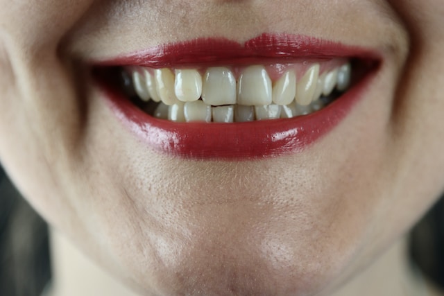 The Effects of Mouth Larvae on Humans: An Uncommon yet ...