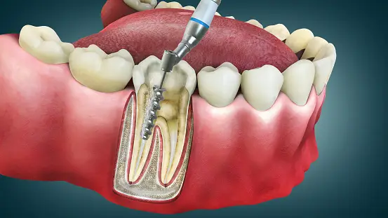 Beyond the Brush: The Comprehensive Guide to Optimal Dental Care Practices 1 Dental Care